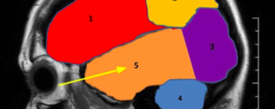 Temporal lobe
