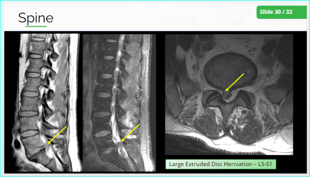 MRI Procedures Module 18: Brain and Spine (1.5 CE Credits) - MRITutor